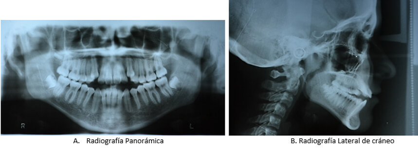 Figura 3. Radiografías