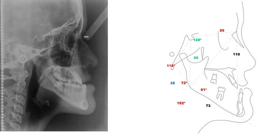 Radiografía cefálica lateral de control. Fig (9)