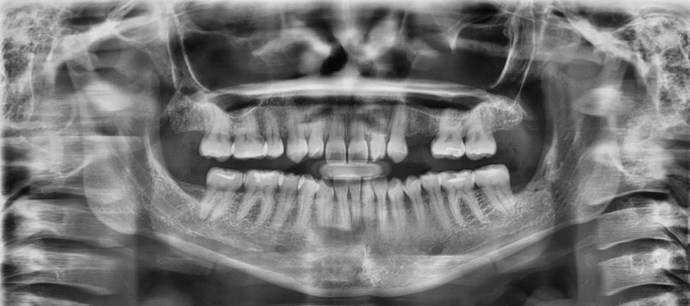 Fig. 5 Radiografía panorámica