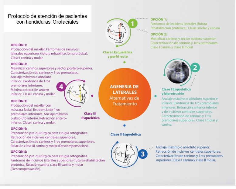 Imagen 4: Pacientes con Agenesia de Incisivos laterales