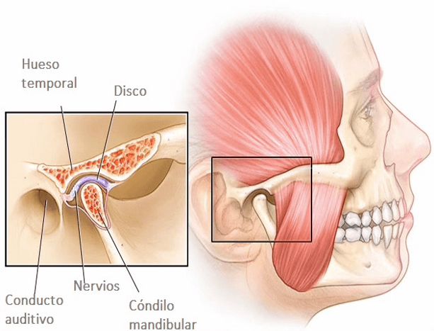 Fig 1. Complejo Cóndilo Discal- Prinicpales estructuras afectadas en la DATM (Tomado de MayoClinic. 2019)