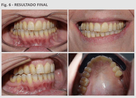 Figura A6 Finalización de los tratamientos primera y segunda etapa. Fuente: Elaboración propia.